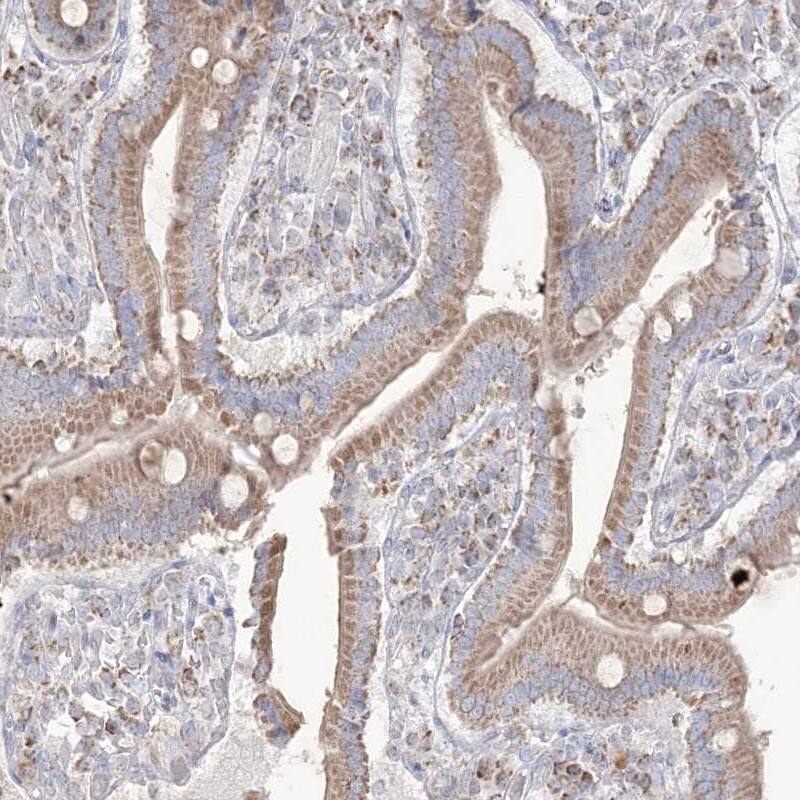 KCTD6 Antibody - BSA Free Immunohistochemistry-Paraffin: KCTD6 Antibody [NBP2-38281]