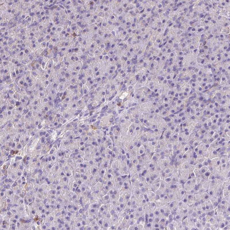 Mitofilin Antibody - BSA Free Immunohistochemistry-Paraffin: Mitofilin Antibody [NBP2-38286]