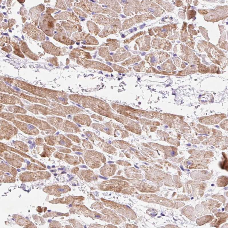 Mitofilin Antibody - BSA Free Immunohistochemistry-Paraffin: Mitofilin Antibody [NBP2-38286]