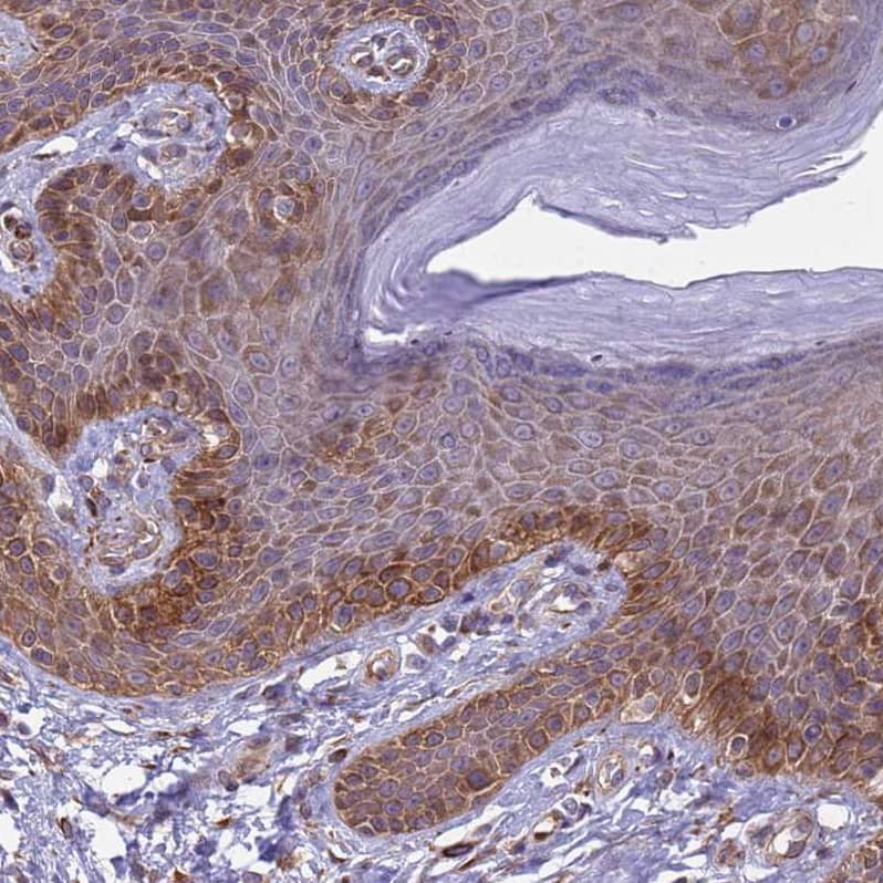 Integrin beta 4/CD104 Antibody - BSA Free Immunohistochemistry-Paraffin: Integrin beta 4/CD104 Antibody [NBP2-38297]