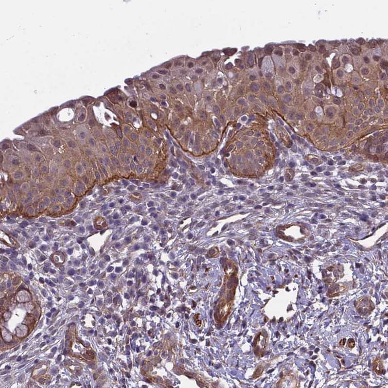 Integrin beta 4/CD104 Antibody - BSA Free Immunohistochemistry-Paraffin: Integrin beta 4/CD104 Antibody [NBP2-38297]