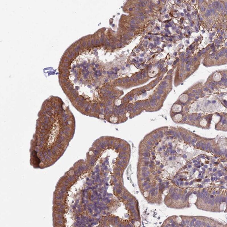 Integrin beta 4/CD104 Antibody - BSA Free Immunohistochemistry-Paraffin: Integrin beta 4/CD104 Antibody [NBP2-38297]