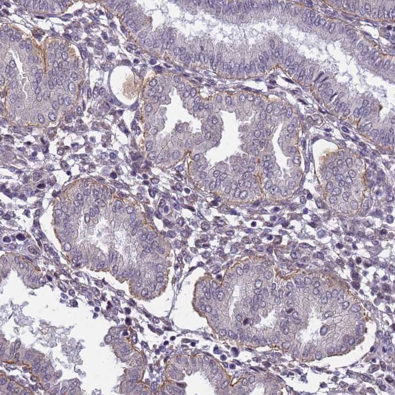 Integrin beta 4/CD104 Antibody - BSA Free Immunohistochemistry-Paraffin: Integrin beta 4/CD104 Antibody [NBP2-38297]