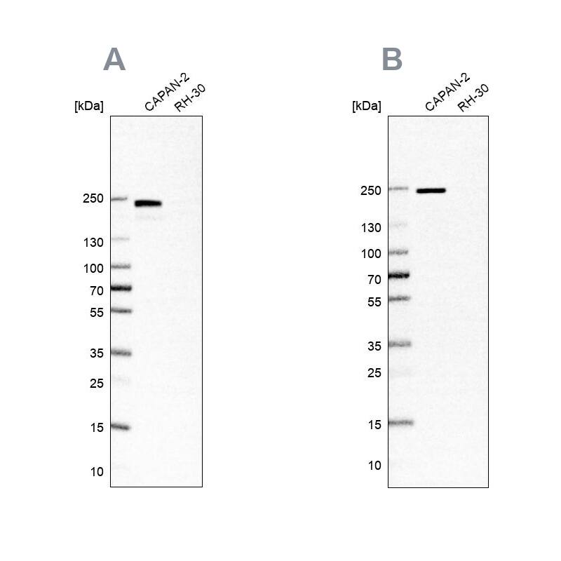Integrin beta 4/CD104 Antibody Western Blot: Integrin beta 4/CD104 Antibody Antibody [NBP2-38297]