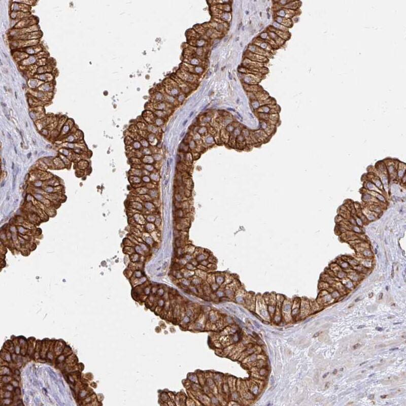 Calpastatin Antibody - BSA Free Immunohistochemistry-Paraffin: Calpastatin Antibody [NBP2-38336]