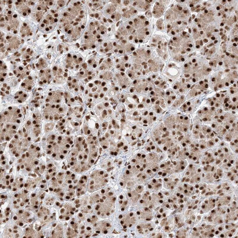 RBM17 Antibody - BSA Free Immunohistochemistry-Paraffin: RBM17 Antibody [NBP2-38348]