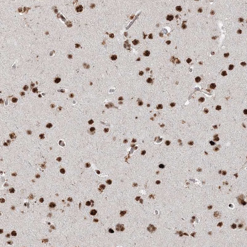 RBM17 Antibody - BSA Free Immunohistochemistry-Paraffin: RBM17 Antibody [NBP2-38348]