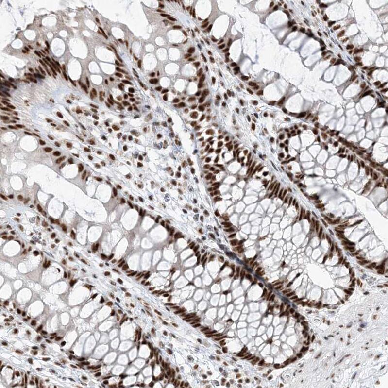 RBM17 Antibody - BSA Free Immunohistochemistry-Paraffin: RBM17 Antibody [NBP2-38348]
