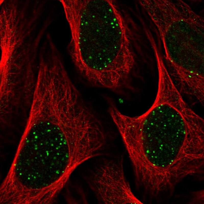 Abraxas Antibody - BSA Free Immunocytochemistry/ Immunofluorescence: Abraxas Antibody [NBP2-38356]