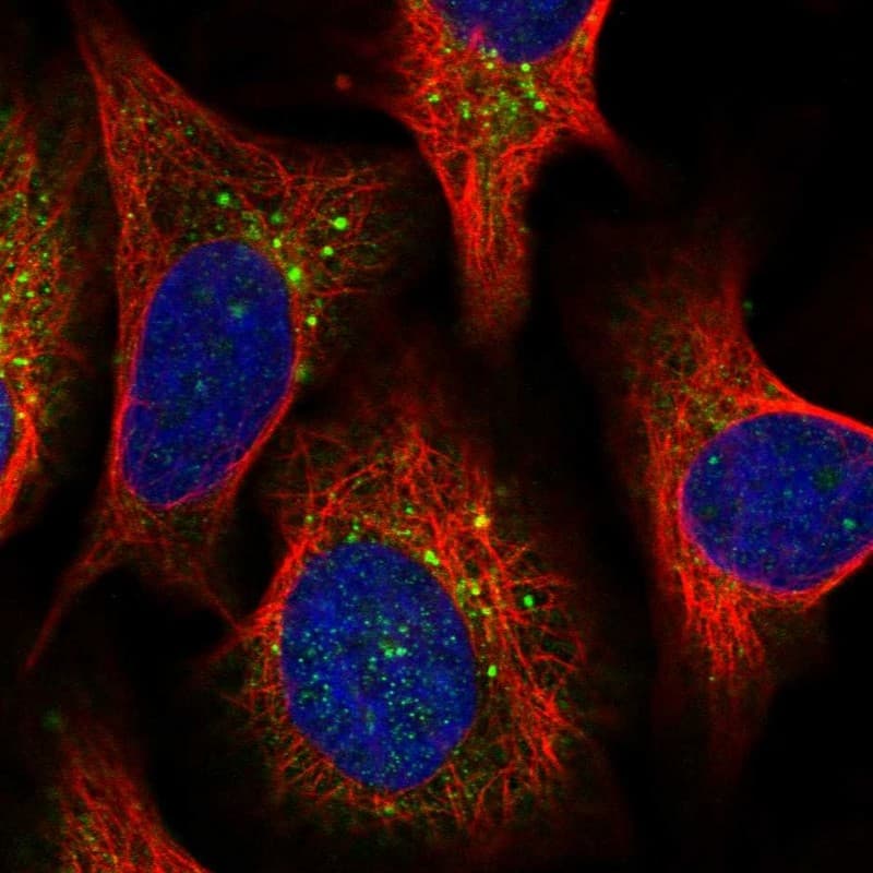 HISPPD1 Antibody - BSA Free Immunocytochemistry/ Immunofluorescence: HISPPD1 Antibody [NBP2-38368]
