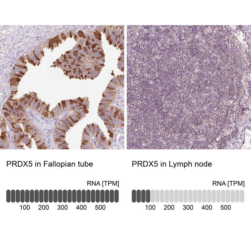 Peroxiredoxin 5 Antibody - BSA Free Immunohistochemistry-Paraffin: Peroxiredoxin 5 Antibody [NBP2-38370]