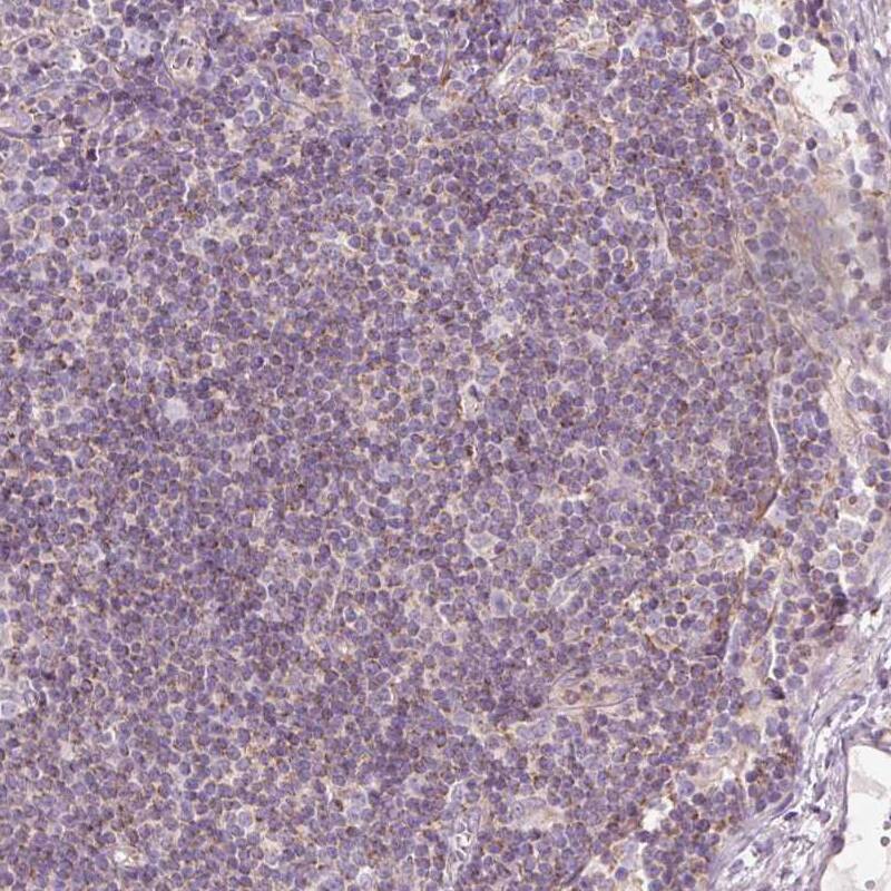 Peroxiredoxin 5 Antibody - BSA Free Immunohistochemistry-Paraffin: Peroxiredoxin 5 Antibody [NBP2-38370]