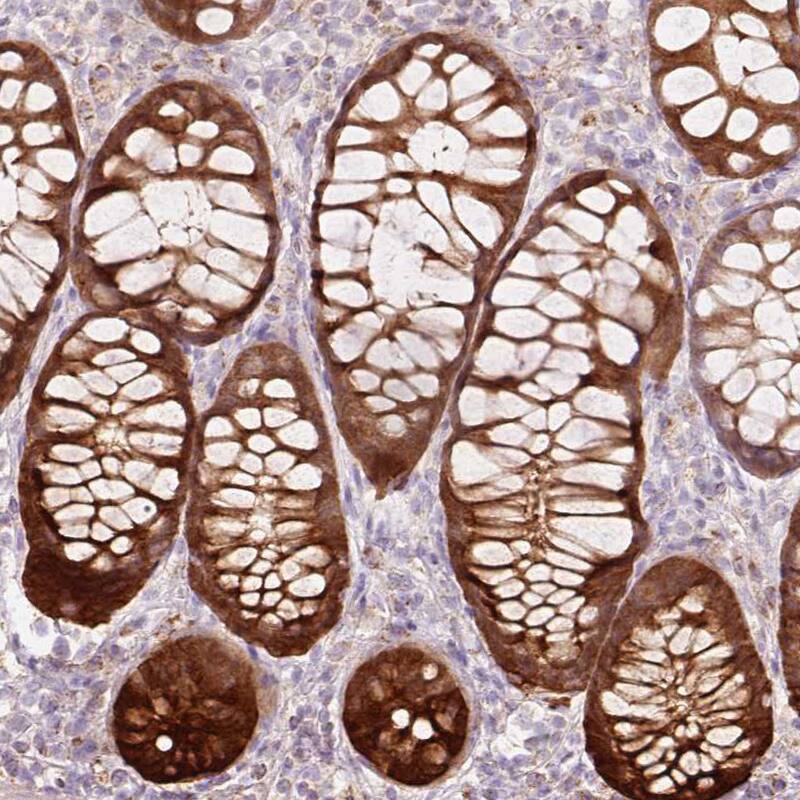 Peroxiredoxin 5 Antibody - BSA Free Immunohistochemistry-Paraffin: Peroxiredoxin 5 Antibody [NBP2-38370]