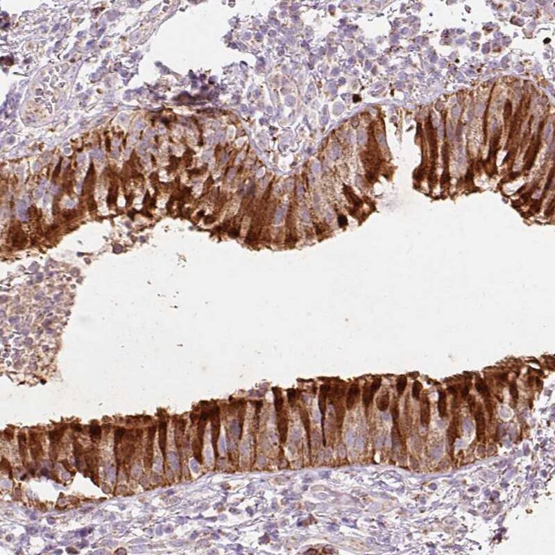 Peroxiredoxin 5 Antibody - BSA Free Immunohistochemistry-Paraffin: Peroxiredoxin 5 Antibody [NBP2-38370]