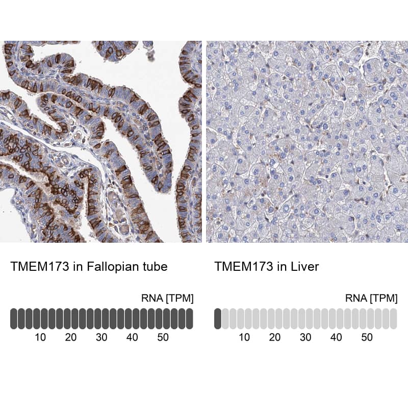 STING/TMEM173 Antibody - BSA Free Immunohistochemistry-Paraffin: STING/TMEM173 Antibody [NBP2-38389]