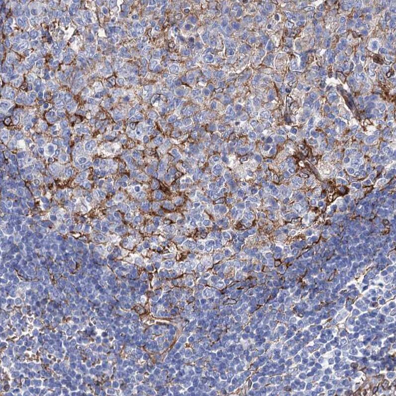 STING/TMEM173 Antibody - BSA Free Immunohistochemistry-Paraffin: STING/TMEM173 Antibody [NBP2-38389]