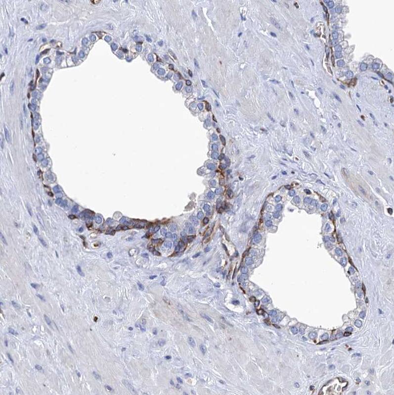 STING/TMEM173 Antibody - BSA Free Immunohistochemistry-Paraffin: STING/TMEM173 Antibody [NBP2-38389]