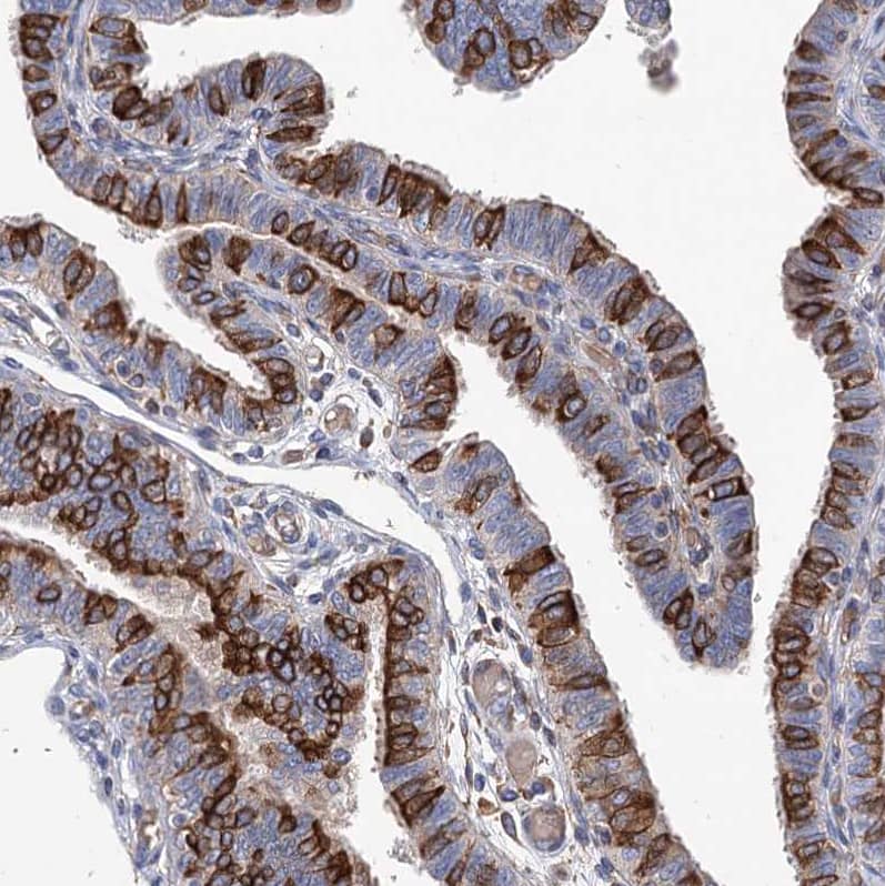 STING/TMEM173 Antibody - BSA Free Immunohistochemistry-Paraffin: STING/TMEM173 Antibody [NBP2-38389]