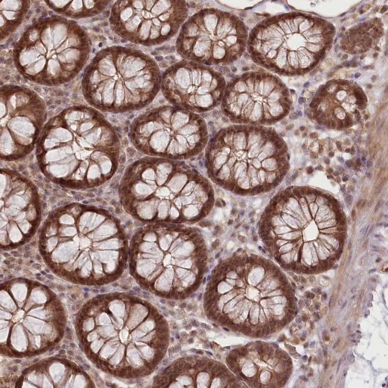R3HDM2 Antibody - BSA Free Immunohistochemistry-Paraffin: R3HDM2 Antibody [NBP2-38405]