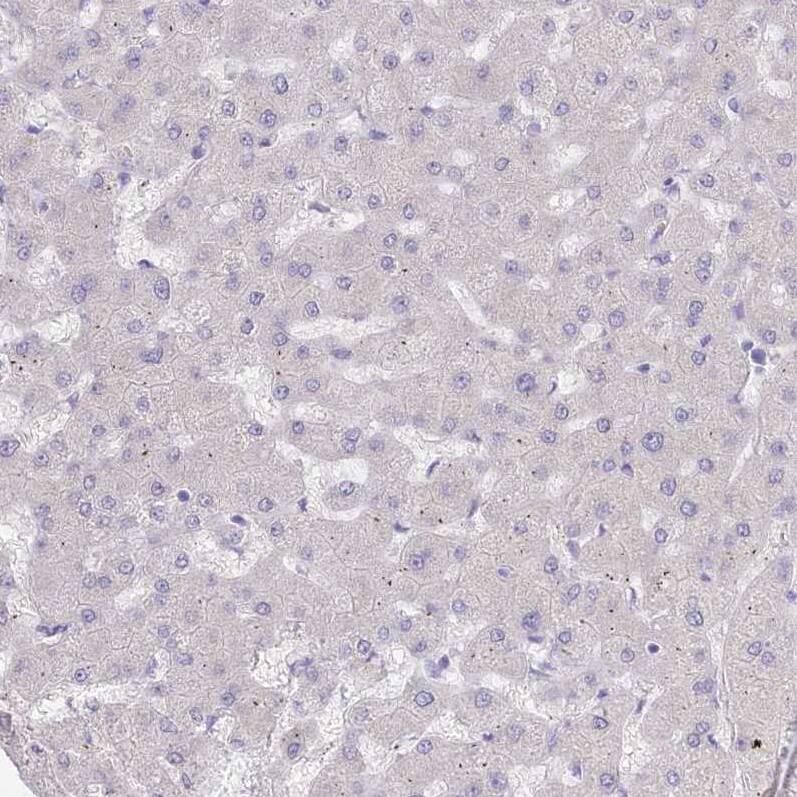 Myozenin 1 Antibody - BSA Free Immunohistochemistry-Paraffin: Myozenin 1 Antibody [NBP2-38412]