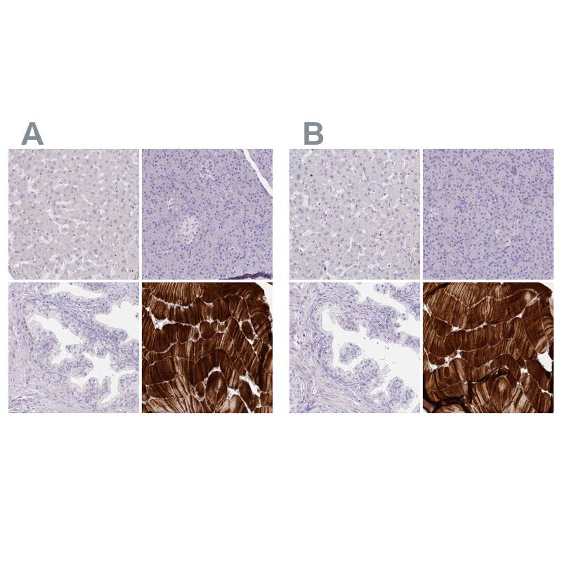 Myozenin 1 Antibody - BSA Free Immunohistochemistry-Paraffin: Myozenin 1 Antibody [NBP2-38412]