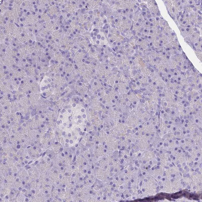 Myozenin 1 Antibody - BSA Free Immunohistochemistry-Paraffin: Myozenin 1 Antibody [NBP2-38412]