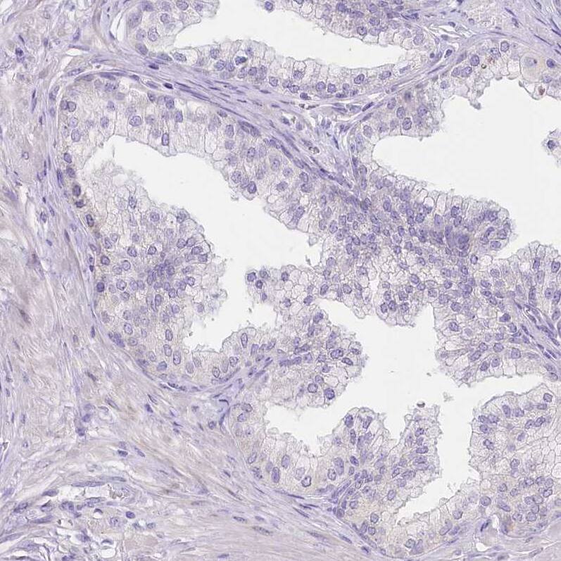 Myozenin 1 Antibody - BSA Free Immunohistochemistry-Paraffin: Myozenin 1 Antibody [NBP2-38412]