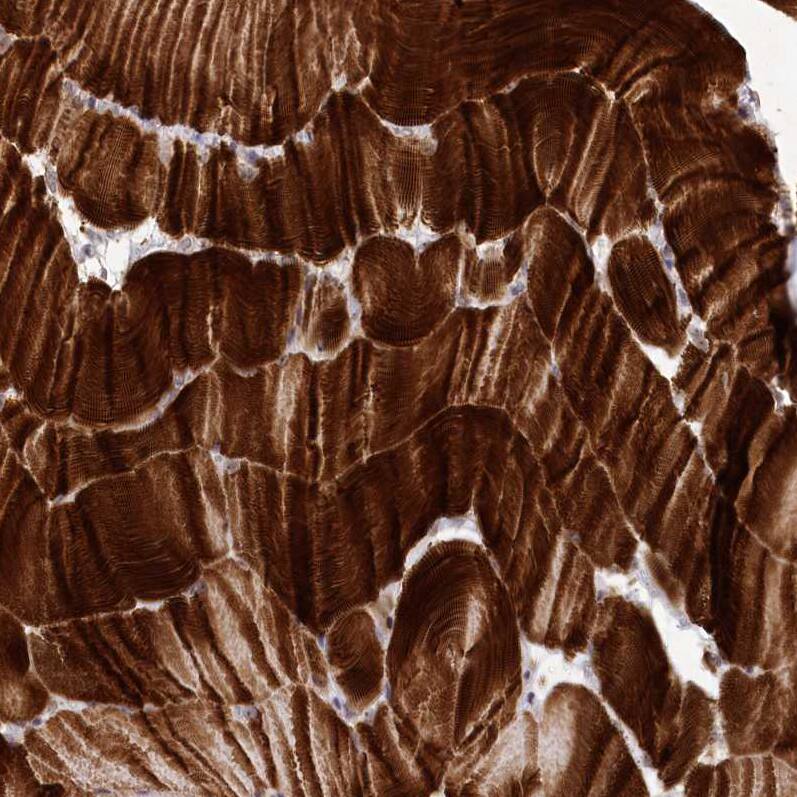 Myozenin 1 Antibody - BSA Free Immunohistochemistry-Paraffin: Myozenin 1 Antibody [NBP2-38412]