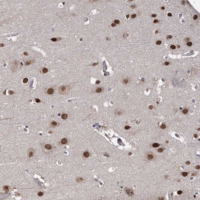 MYG1 Antibody - BSA Free Immunohistochemistry-Paraffin: MYG1 Antibody [NBP2-38422]