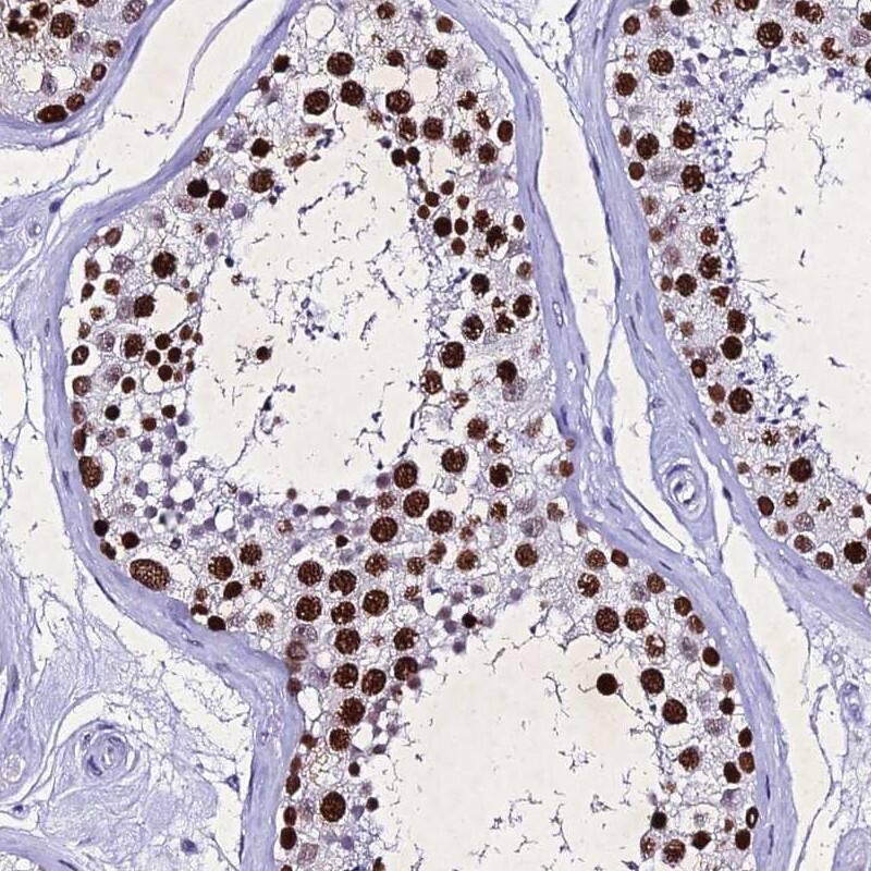 PPP4R2 Antibody - BSA Free Immunohistochemistry-Paraffin: PPP4R2 Antibody [NBP2-38453]