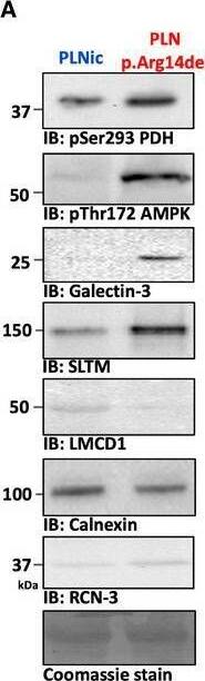 SLTM Antibody - BSA Free