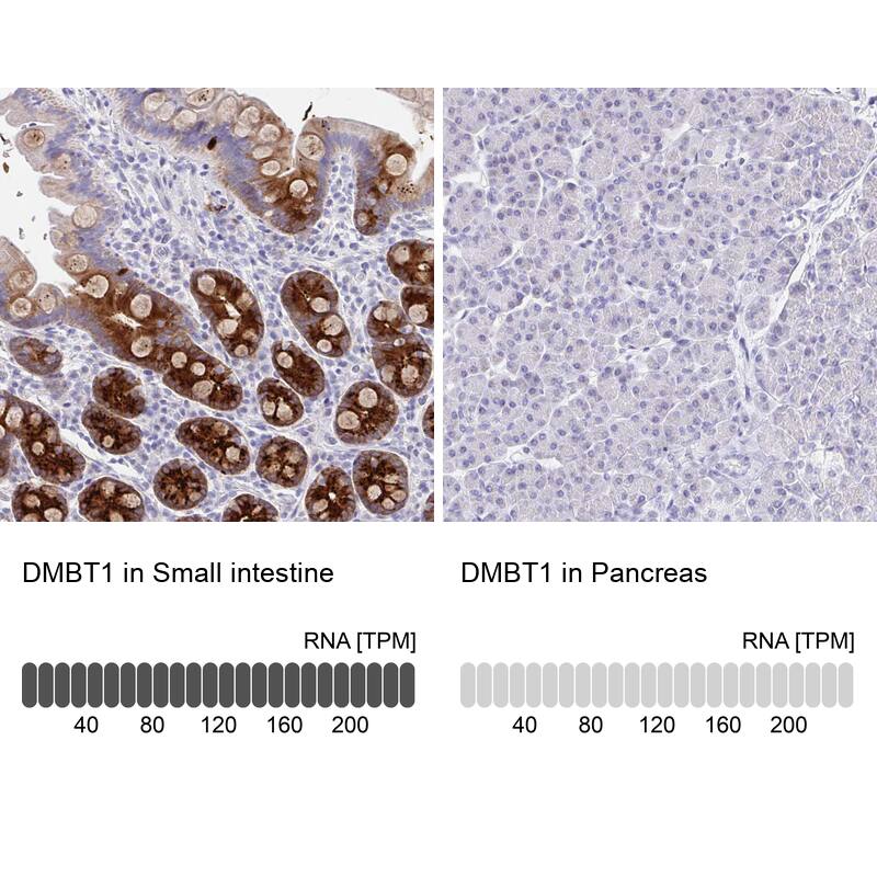 DMBT1/GP340 Antibody - BSA Free Immunohistochemistry-Paraffin: DMBT1/GP340 Antibody [NBP2-38471]