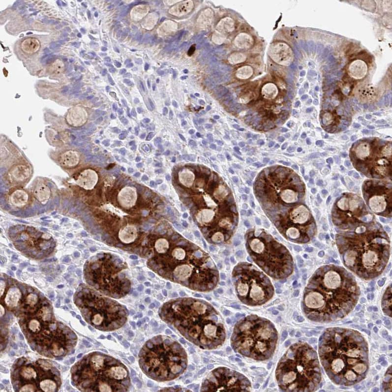 DMBT1/GP340 Antibody - BSA Free Immunohistochemistry-Paraffin: DMBT1/GP340 Antibody [NBP2-38471]