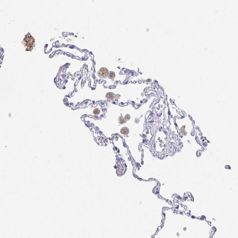 DMBT1/GP340 Antibody - BSA Free Immunohistochemistry-Paraffin: DMBT1/GP340 Antibody [NBP2-38471]
