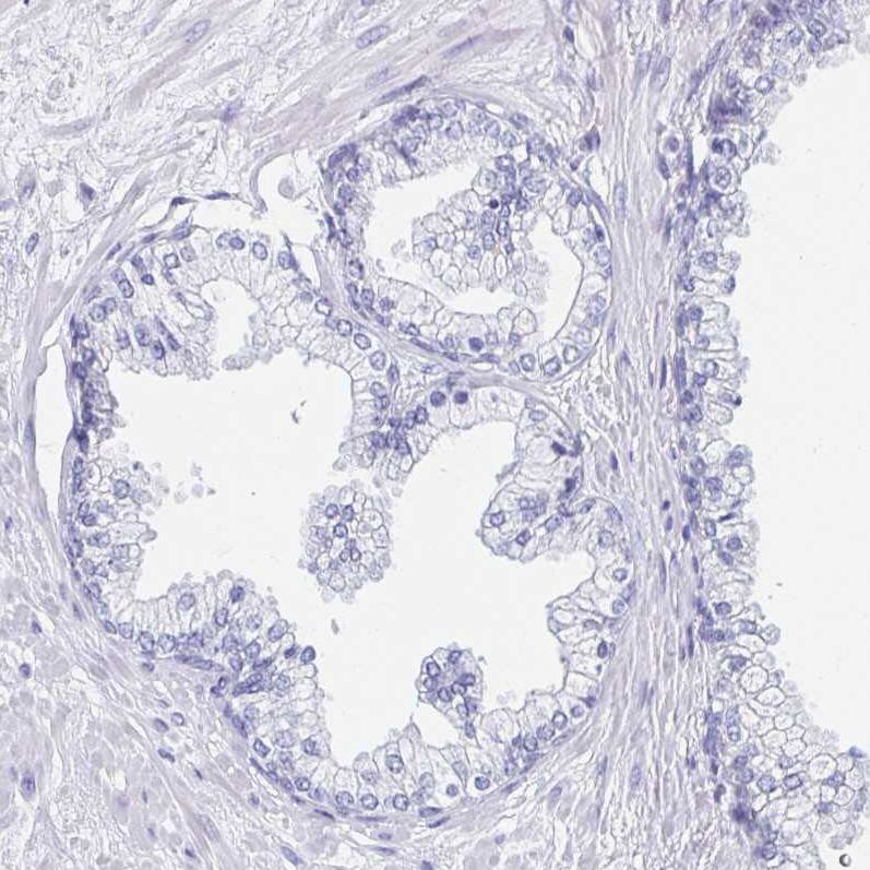 DMBT1/GP340 Antibody - BSA Free Immunohistochemistry-Paraffin: DMBT1/GP340 Antibody [NBP2-38471]