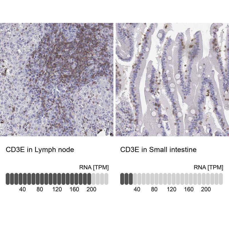 CD3 epsilon Antibody - BSA Free Immunohistochemistry-Paraffin: CD3 epsilon Antibody [NBP2-38479]