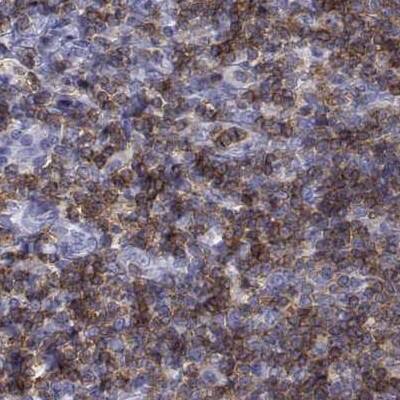 CD3 epsilon Antibody - BSA Free Immunohistochemistry-Paraffin: CD3 epsilon Antibody [NBP2-38479]