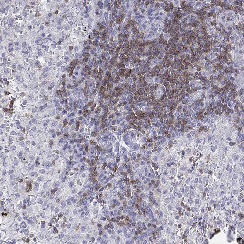 CD3 epsilon Antibody - BSA Free Immunohistochemistry-Paraffin: CD3 epsilon Antibody [NBP2-38479]
