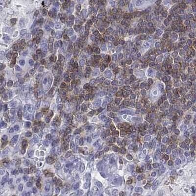CD3 epsilon Antibody - BSA Free Immunohistochemistry-Paraffin: CD3 epsilon Antibody [NBP2-38479]