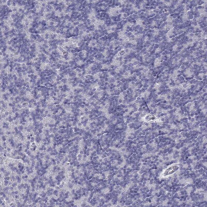 CD3 epsilon Antibody - BSA Free Immunohistochemistry-Paraffin: CD3 epsilon Antibody [NBP2-38479]