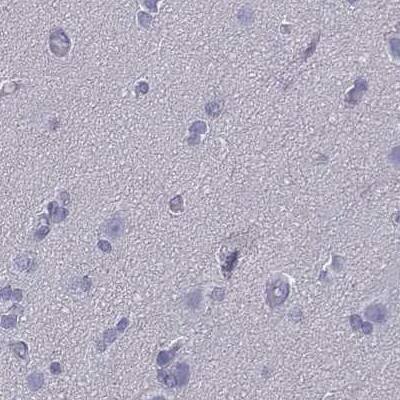 CD3 epsilon Antibody - BSA Free Immunohistochemistry-Paraffin: CD3 epsilon Antibody [NBP2-38479]