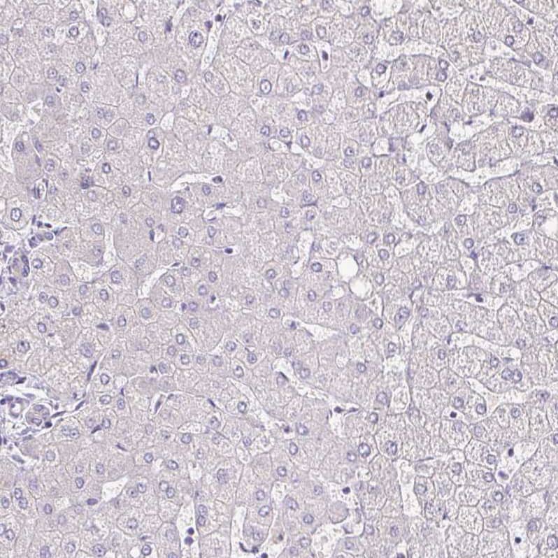 IL-18 BPa/IL18BP Antibody - BSA Free Immunohistochemistry-Paraffin: IL-18 BPa/IL18BP Antibody [NBP2-38481] -