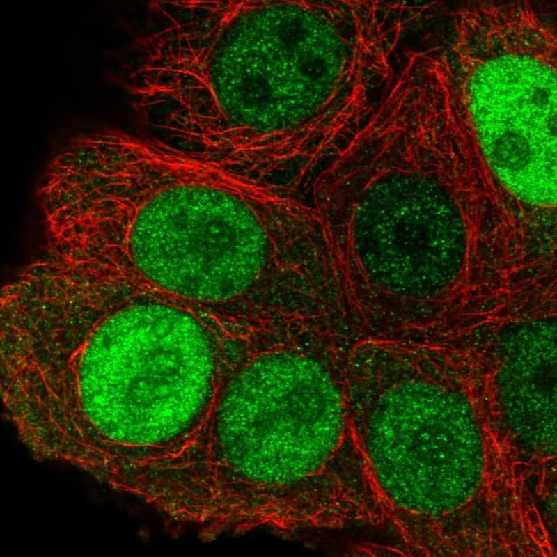 Importin alpha 2/KPNA2 Antibody - BSA Free Immunocytochemistry/ Immunofluorescence: Importin alpha 2/KPNA2 Antibody [NBP2-38482]