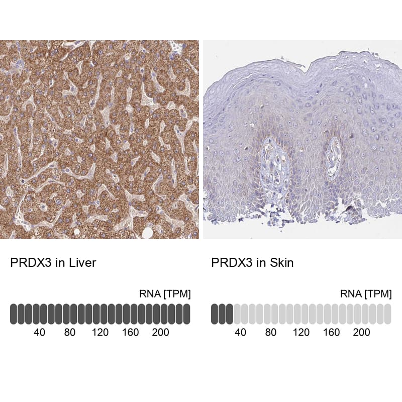 Peroxiredoxin 3 Antibody - BSA Free Immunohistochemistry-Paraffin: Peroxiredoxin 3 Antibody [NBP2-38486]