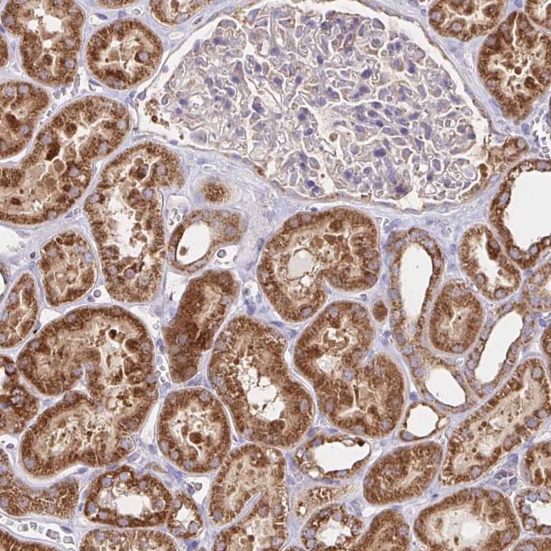 Peroxiredoxin 3 Antibody - BSA Free Immunohistochemistry-Paraffin: Peroxiredoxin 3 Antibody [NBP2-38486]