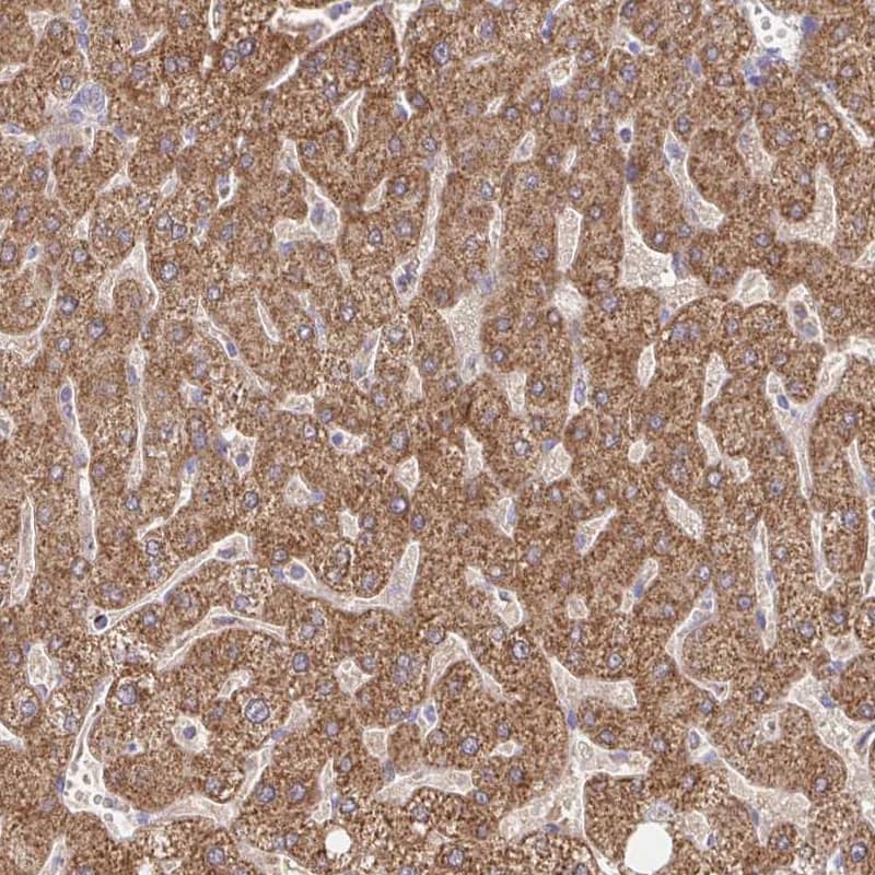Peroxiredoxin 3 Antibody - BSA Free Immunohistochemistry-Paraffin: Peroxiredoxin 3 Antibody [NBP2-38486]