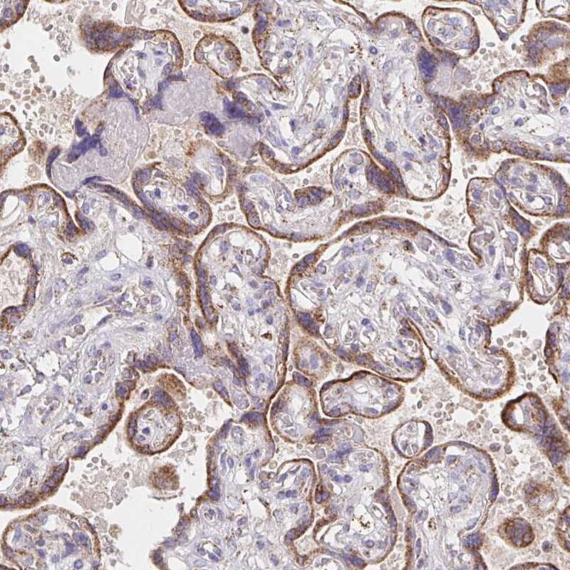 Peroxiredoxin 3 Antibody - BSA Free Immunohistochemistry-Paraffin: Peroxiredoxin 3 Antibody [NBP2-38486]