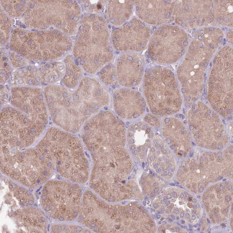 TYW1 Antibody Immunohistochemistry-Paraffin: TYW1 Antibody [NBP2-38503]