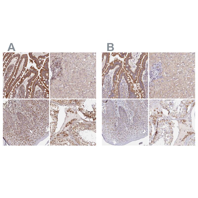 MAVS Antibody Immunohistochemistry-Paraffin: MAVS Antibody Antibody [NBP2-38613]