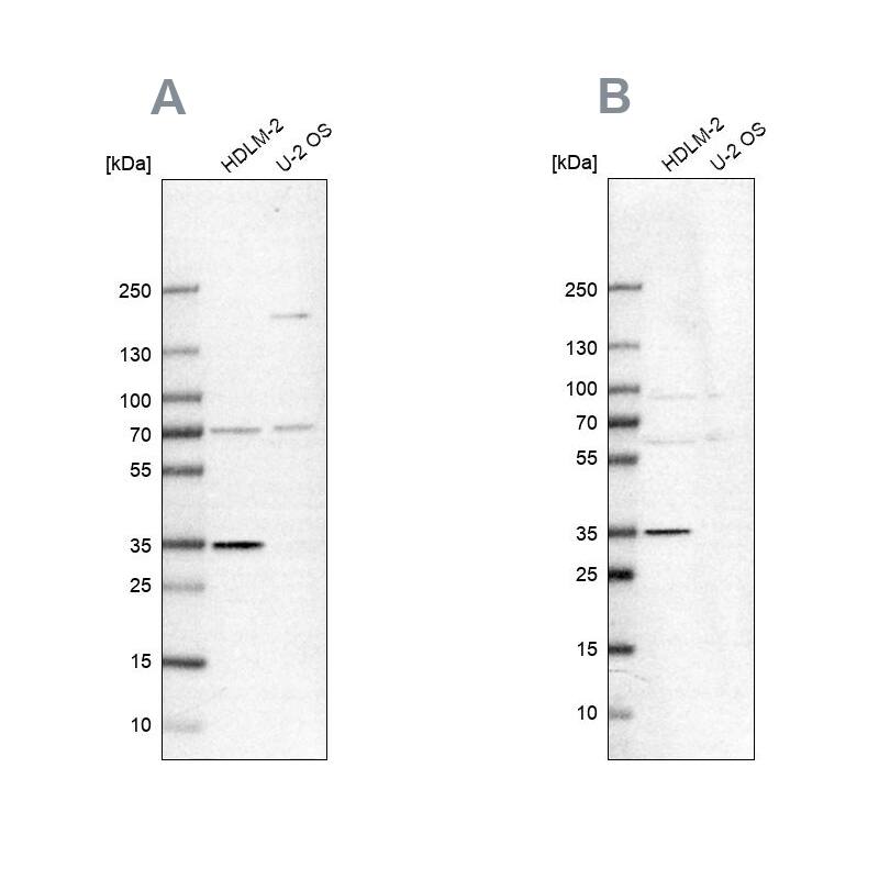 TTC19 Antibody Western Blot: TTC19 Antibody Antibody [NBP2-38667]